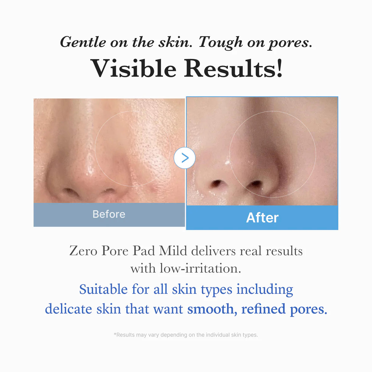 MEDICUBE Zero Pore Pad Mild 155 g (70 db)