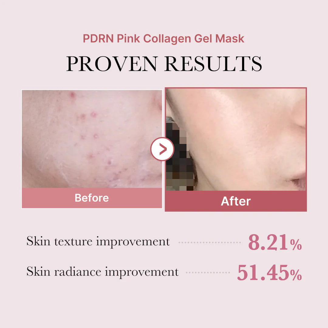 MEDICUBE PDRN Pink Collagen Gel Mask 4× 28 g