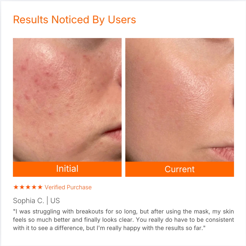 Targeted LED Facial Mask