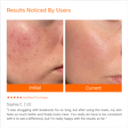 Targeted LED Facial Mask