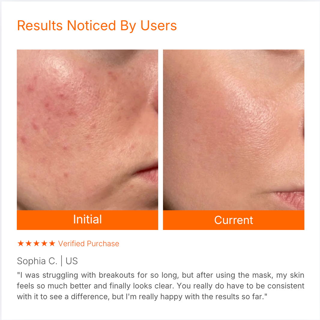 Targeted LED Facial Mask