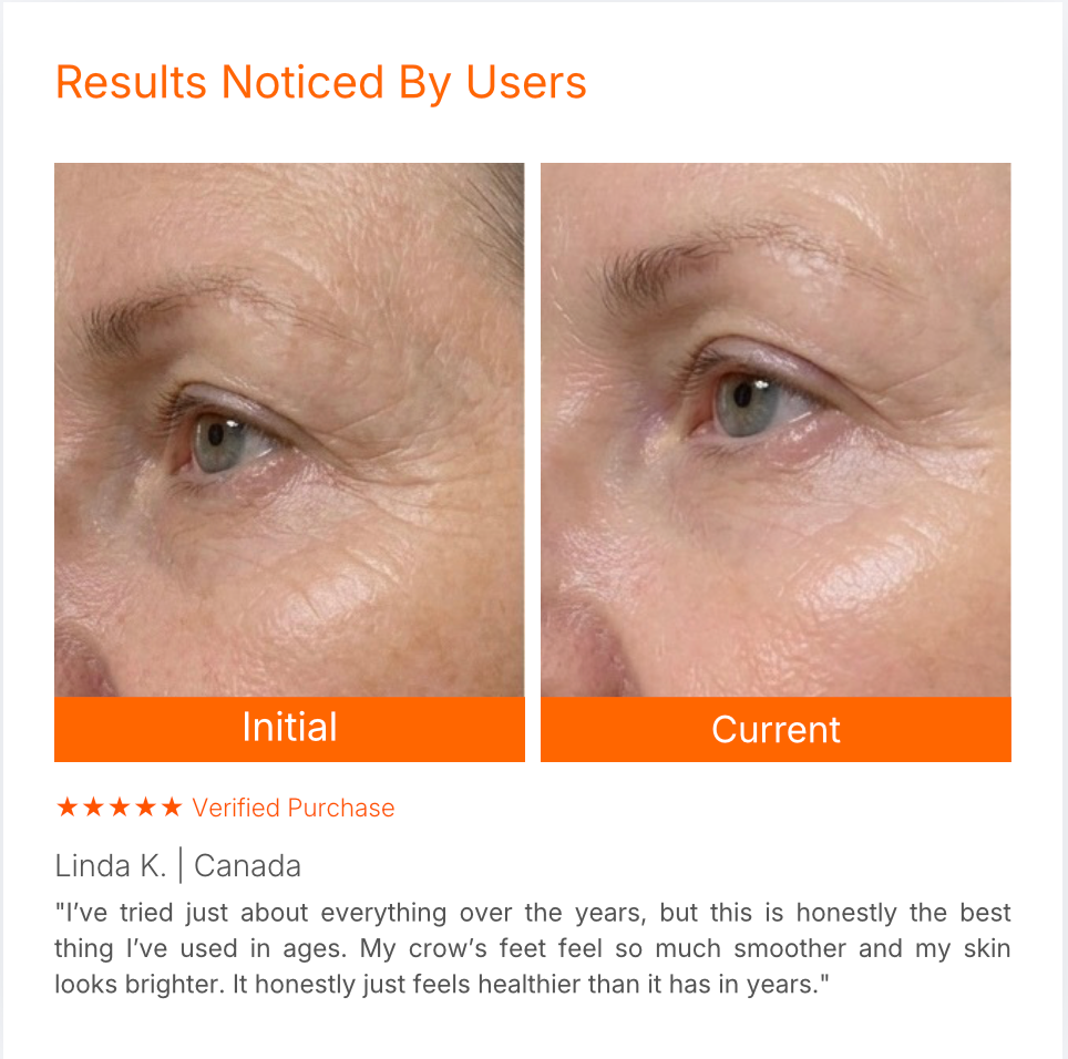 Targeted LED Facial Mask