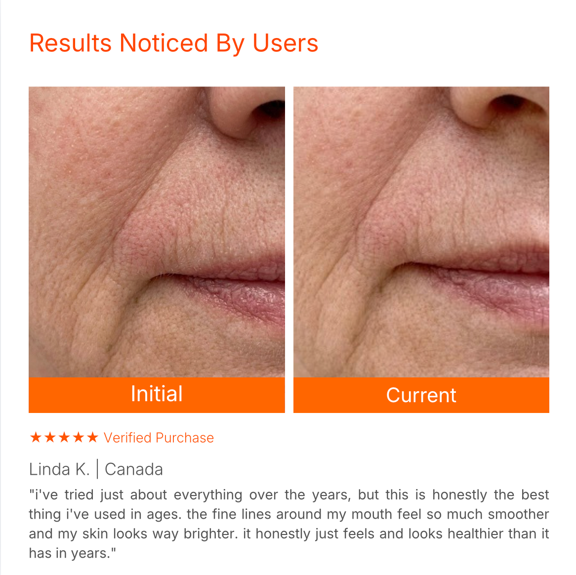 Targeted LED Facial Mask